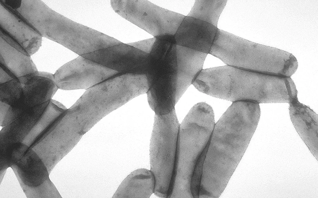 Prevenzione della Legionella