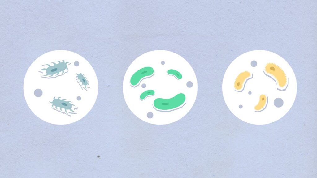 legionella in Lombardia