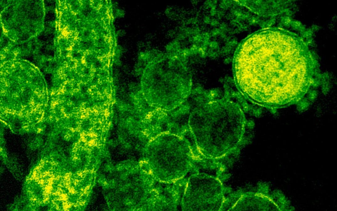 Acqua sicura: proteggi la tua salute da batteri e virus